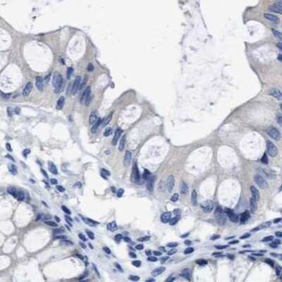 Immunohistochemistry-Paraffin: HOOK1 Antibody [NBP1-81745] - Staining of human colon.