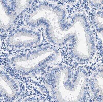 Immunohistochemistry-Paraffin: HOOK1 Antibody [NBP1-81745] - Staining of human endometrium shows no cytoplasmic positivity in glandular cells as expected.