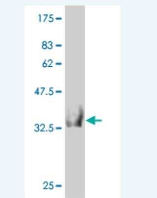 Western Blot: HOOK2 Antibody (1E10) [H00029911-M03] - Detection against Immunogen (36.74 KDa) .