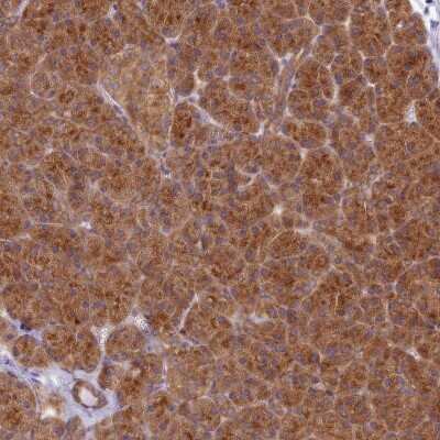 Immunohistochemistry: HOOK2 Antibody [NBP2-47429] - Staining of human pancreas shows strong cytoplasmic positivity in exocrine glandular cells.