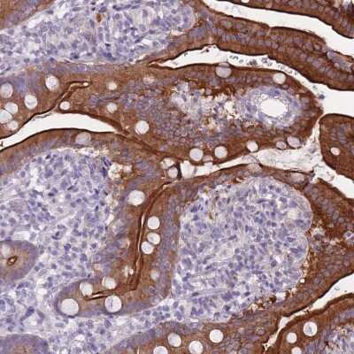 Immunohistochemistry: HOOK2 Antibody [NBP2-47430] - Staining of human duodenum shows strong luminal membranous and cytoplasmic positivity in glandular cells.