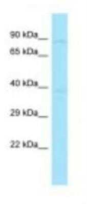 Western Blot: HOOK2 Antibody [NBP1-98586] - Rat Brain Lysate 1.0ug/ml, Gel Concentration: 12%