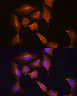 Immunocytochemistry/Immunofluorescence: HOOK3 Antibody [NBP3-05070] - Analysis of C6 cells using HOOK3 antibody at dilution of 1:100. Blue: DAPI for nuclear staining.