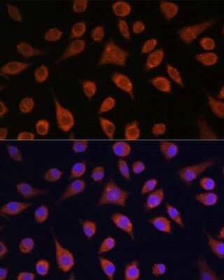 Immunocytochemistry/Immunofluorescence: HOOK3 Antibody [NBP3-05070] - Analysis of L929 cells using HOOK3 antibody at dilution of 1:100. Blue: DAPI for nuclear staining.