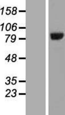 Western Blot: HOOK3 Overexpression Lysate (Adult Normal) [NBL1-11660] Left-Empty vector transfected control cell lysate (HEK293 cell lysate); Right -Over-expression Lysate for HOOK3.