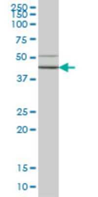 Western Blot: HORMAD1 Antibody (2E5) [H00084072-M01] - HORMAD1 monoclonal antibody (M01), clone 2E5 Analysis of HORMAD1 expression in HepG2.