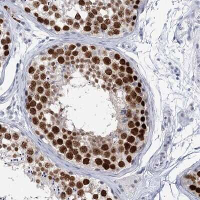 Immunohistochemistry-Paraffin HORMAD1 Antibody