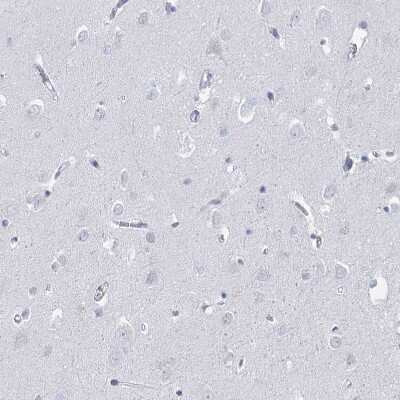 Immunohistochemistry-Paraffin HORMAD1 Antibody