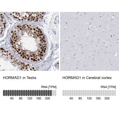 Immunohistochemistry-Paraffin HORMAD1 Antibody