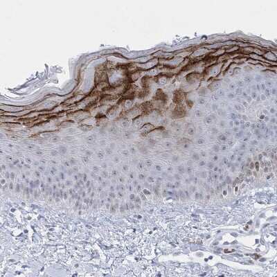 Immunohistochemistry-Paraffin: HORMAD1 Antibody [NBP1-85401] - Staining of human skin shows cytoplasmic positivity in a subset of squamous epithelial cells.