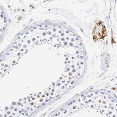 Immunohistochemistry-Paraffin HORMAD2 Antibody