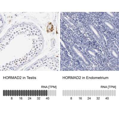 Immunohistochemistry-Paraffin HORMAD2 Antibody