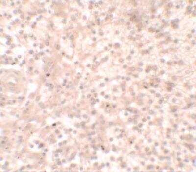 Immunohistochemistry: HOX11 Antibody [NBP2-81887] - Analysis of HOX11 in human spleen tissue with HOX11 antibody at 2.5 ug/ml.