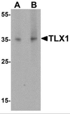 Western Blot: HOX11 Antibody [NBP2-81887] - Analysis of HOX11 in mouse spleen tissue lysate with HOX11 antibody at (A) 1 and (B) 2 ug/ml.