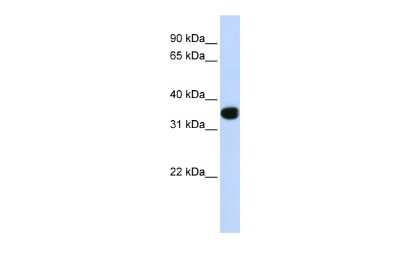 Western Blot: HOX11 Antibody [NBP2-84075] - WB Suggested Anti-TLX1 Antibody Titration: 0.2-1 ug/ml. ELISA Titer: 1:312500. Positive Control: Human heart