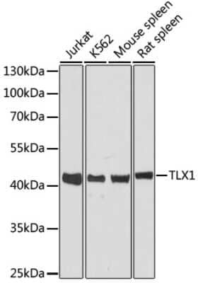 Western Blot: HOX11 Antibody [NBP3-03317] - Analysis of extracts of various cell lines, using HOx11 antibody at 1:3000 dilution. Secondary antibody: HRP Goat Anti-Rabbit IgG (H+L) at 1:10000 dilution. Lysates/proteins: 25ug per lane. Blocking buffer: 3% nonfat dry milk in TBST. Detection: ECL Basic Kit.