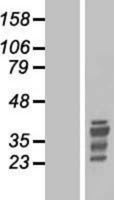 Western Blot: HOX11 Overexpression Lysate (Adult Normal) [NBP2-10462] Left-Empty vector transfected control cell lysate (HEK293 cell lysate); Right -Over-expression Lysate for HOX11.