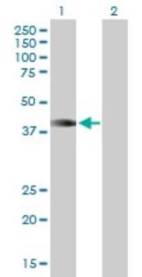 Western Blot: HOXA1 Antibody [H00003198-B01P] - Analysis of HOXA1 expression in transfected 293T cell line by HOXA1 polyclonal antibody.  Lane 1: HOXA1 transfected lysate(36.85 KDa). Lane 2: Non-transfected lysate.