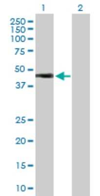 Western Blot: HOXA1 Antibody [H00003198-D01P] - Analysis of HOXA1 expression in transfected 293T cell line by HOXA1 polyclonal antibody.Lane 1: HOXA1 transfected lysate(36.60 KDa).Lane 2: Non-transfected lysate.