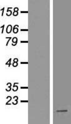 Western Blot: HOXA1 Overexpression Lysate (Adult Normal) [NBP2-05236] Left-Empty vector transfected control cell lysate (HEK293 cell lysate); Right -Over-expression Lysate for HOXA1.