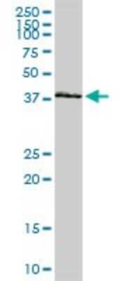 Western Blot: HOXA11 Antibody [H00003207-D01P] - Analysis of HOXA11 expression in human pancreas.