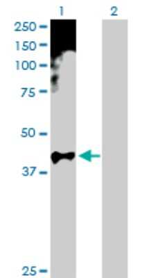 Western Blot: HOXA11 Antibody [H00003207-D01P] - Analysis of HOXA11 expression in transfected 293T cell line by HOXA11 polyclonal antibody.Lane 1: HOXA11 transfected lysate(34.50 KDa).Lane 2: Non-transfected lysate.