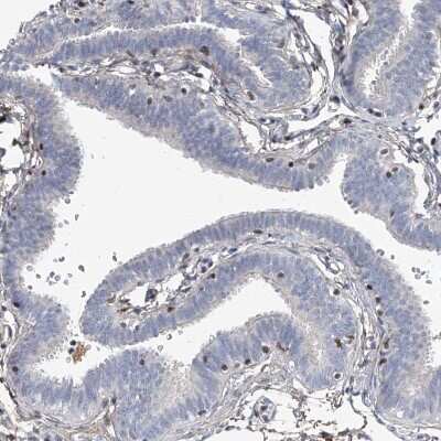 Immunohistochemistry-Paraffin: HOXA3 Antibody [NBP1-83234] - Staining of human fallopian tube shows moderate nuclear positivity in a subset of glandular cells.