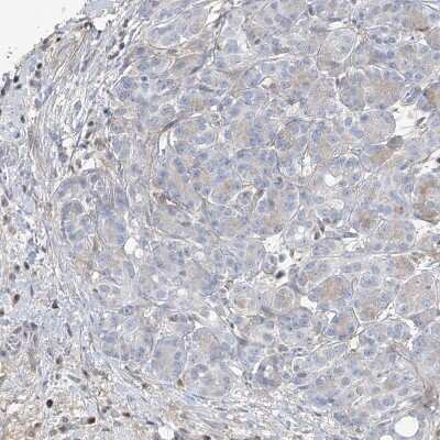 Immunohistochemistry-Paraffin: HOXA3 Antibody [NBP1-83234] - Staining of human pancreas shows no nuclear positivity in exocrine glandular cells as expected.