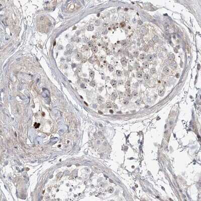 Immunohistochemistry-Paraffin: HOXA3 Antibody [NBP1-83234] - Staining of human testis shows weak to moderate nuclear positivity in a subset of cells in seminiferous ducts.