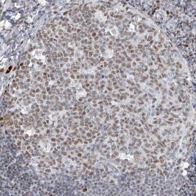 Immunohistochemistry-Paraffin: HOXA3 Antibody [NBP1-83234] - Staining of human tonsil shows weak to moderate nuclear positivity in germinal center cells.