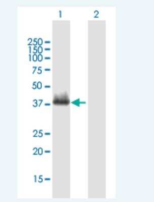 Western Blot: HOXA4 Antibody [H00003201-B01P-50ug] - Analysis of HOXA4 expression in transfected 293T cell line (H00003201-T01) by HOXA4 MaxPab polyclonal antibody.  Lane 1: HOXA4 transfected lysate(35.2 KDa). Lane 2: Non-transfected lysate