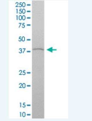 Western Blot: HOXA4 Antibody [H00003201-B01P-50ug] - Analysis of HOXA4 expression in human kidney.