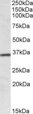 Western Blot: HOXA4 Antibody [NBP1-52039] - NBP1-52039 (0.1ug/ml) staining of Human Colon lysate (35ug protein in RIPA buffer). Primary incubation was 1 hour. Detected by chemiluminescence.