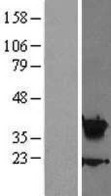 Western Blot: HOXA5 Overexpression Lysate (Adult Normal) [NBL1-11668] Left-Empty vector transfected control cell lysate (HEK293 cell lysate); Right -Over-expression Lysate for HOXA5.