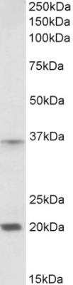 Western Blot: HOXA9 Antibody [NBP1-52166] - Staining of Moue Spleen lysate (35 ug protein in RIPA buffer). Primary incubation was 1 hour. Detected by chemiluminescence.  