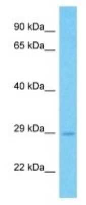 Western Blot: HOXA9 Antibody [NBP3-09930] - Western blot analysis of HOXA9 in Jurkat Whole Cell lysates. Antibody dilution at 1.0ug/ml