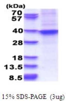 SDS-Page: HOXA9 Recombinant Protein [NBP2-51680] - 15% SDS Page (3 ug)