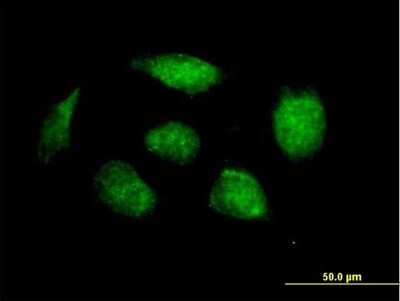 Immunocytochemistry/Immunofluorescence: HOXB1 Antibody [H00003211-B01P] - Analysis of purified antibody to HOXB1 on HeLa cell. (antibody concentration 10 ug/ml)