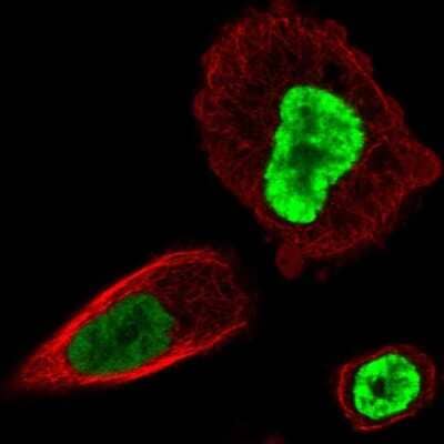 Immunocytochemistry/Immunofluorescence: HOXB13 Antibody [NBP2-48778] - Staining of human cell line PC-3 shows localization to nucleoplasm. Antibody staining is shown in green.