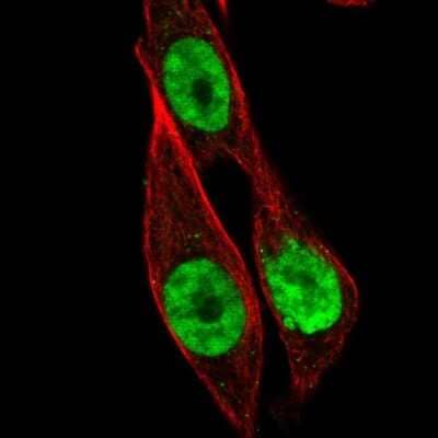 Immunocytochemistry/Immunofluorescence: HOXB13 Antibody [NBP2-49375] - Staining of human cell line PC-3 shows localization to nucleoplasm.