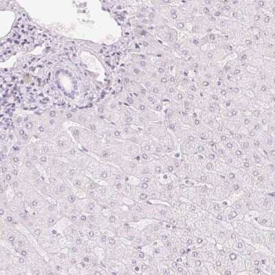 Immunohistochemistry-Paraffin: HOXB13 Antibody [NBP2-48778] - Staining of human liver shows low expression as expected.