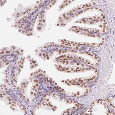 Immunohistochemistry-Paraffin: HOXB13 Antibody [NBP2-48778] - Staining of human prostate shows high expression.