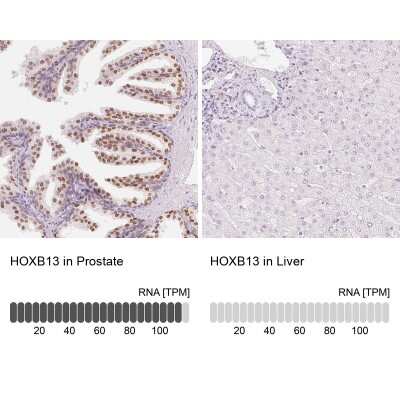 Immunohistochemistry-Paraffin: HOXB13 Antibody [NBP2-48778] - Staining in human prostate and liver tissues using anti-HOXB13 antibody. Corresponding HOXB13 RNA-seq data are presented for the same tissues.