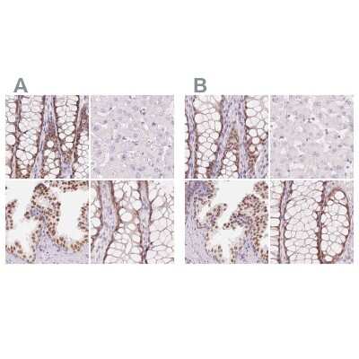 <b>Independent Antibodies Validation and Orthogonal Strategies Validation.</b>Immunohistochemistry-Paraffin: HOXB13 Antibody [NBP2-48778] - Staining of human colon, liver, prostate and rectum using Anti-HOXB13 antibody NBP2-48778 (A) shows similar protein distribution across tissues to independent antibody NBP2-49375 (B).