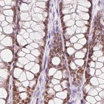 Immunohistochemistry-Paraffin: HOXB13 Antibody [NBP2-48778] - Staining of human colon.