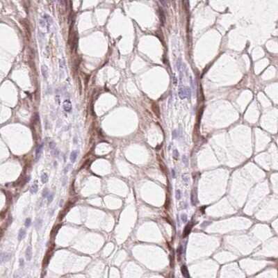 Immunohistochemistry-Paraffin: HOXB13 Antibody [NBP2-48778] - Staining of human rectum.