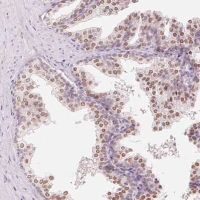 Immunohistochemistry-Paraffin: HOXB13 Antibody [NBP2-49375] - Staining of human prostate shows high expression.