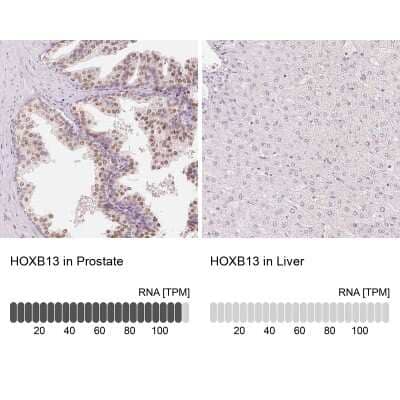 <b>Orthogonal Strategies Validation. </b>Immunohistochemistry-Paraffin: HOXB13 Antibody [NBP2-49375] - Staining in human prostate and liver tissues using anti-HOXB13 antibody. Corresponding HOXB13 RNA-seq data are presented for the same tissues.