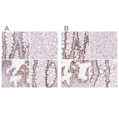 <b>Independent Antibodies Validation. </b>Immunohistochemistry-Paraffin: HOXB13 Antibody [NBP2-49375] - Staining of human colon, liver, prostate and rectum using Anti-HOXB13 antibody NBP2-49375 (A) shows similar protein distribution across tissues to independent antibody NBP2-48778 (B).