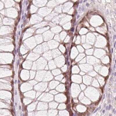 Immunohistochemistry-Paraffin: HOXB13 Antibody [NBP2-49375] - Staining of human rectum.